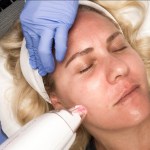 LaseMD Laser Facial Treatment, Laser Skincare Treatment, Refined Dermatology, Bay Area Skincare, Have Need Want
