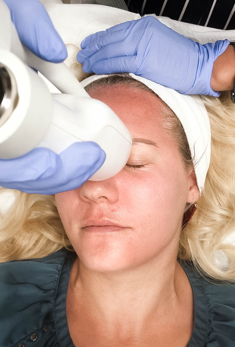LaseMD Laser Facial Treatment, Laser Skincare Treatment, Refined Dermatology, Bay Area Skincare, Have Need Want