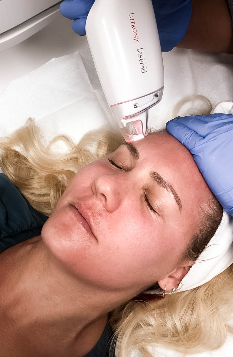 LaseMD Laser Facial Treatment, Laser Skincare Treatment, Refined Dermatology, Bay Area Skincare, Have Need Want