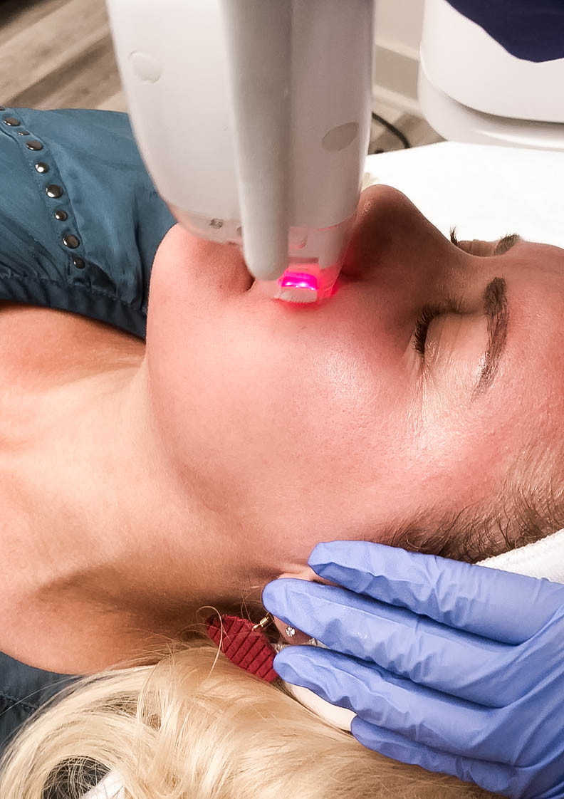 LaseMD Laser Facial Treatment, Laser Skincare Treatment, Refined Dermatology, Bay Area Skincare, Have Need Want